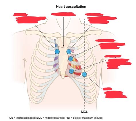 Heart Auscultation Diagram | Quizlet