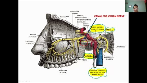 Vidian nerve canal - An important structure in anterior skull base surgery - YouTube