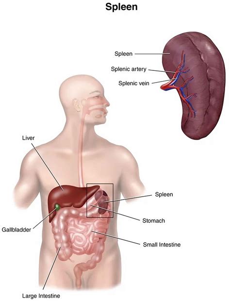 Splenic infarction causes, symptoms, diagnosis, treatment & prognosis