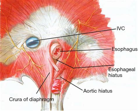 Esophageal hiatus – Anatomy, Location, Function, Hernia and Pictures ...