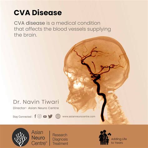 What is Cerebrovascular Accident (CVA) Disease, Symptoms, Causes, Treatment