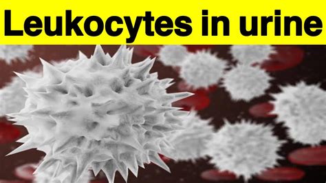 Leukocytes in urine | How to get rid of leukocytes in urine without antibiotics| Leukocytes ...