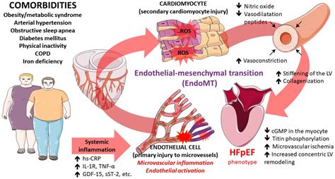 slsi.lk - how long for sulfatrim to work | What is congestive heart failure with preserved ...