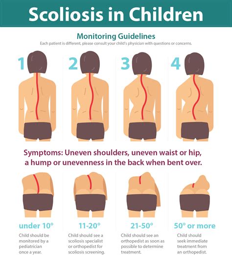 Scoliosis, Kyphosis and SMA | National Scoliosis Center