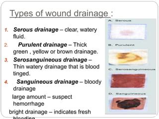 Wounds | PPT