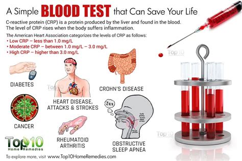 A Simple Blood Test that Can Save Your Life | Top 10 Home Remedies