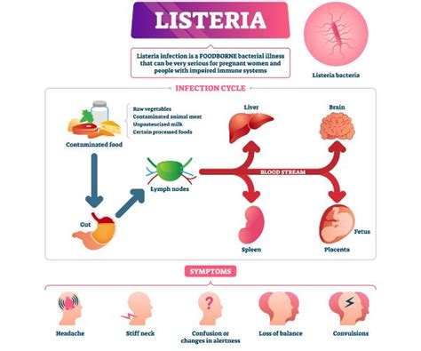 Listeria Monocytogenes: Symptoms, Treatment, Prevention & Risk Factors