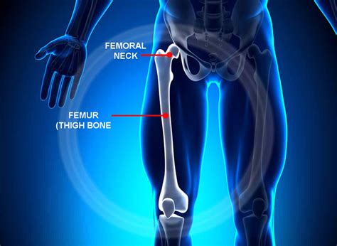 Sports Performance Bulletin - Endurance injuries and health - Femoral ...