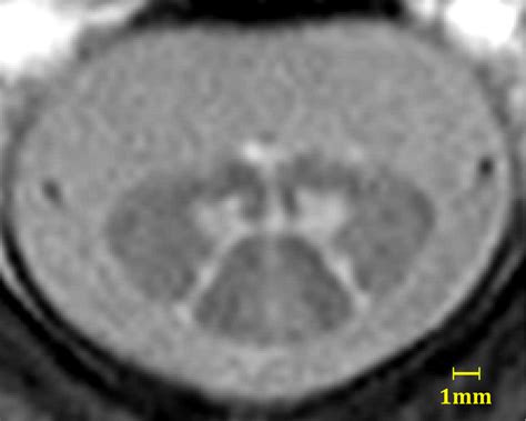 Neuro MRI | Department of Biomedical Engineering | University of Basel