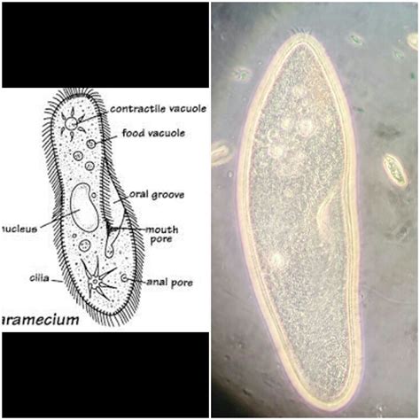 I'm an amateur, but here's a paramecium under a phase contrast scope! I believe the smaller ...