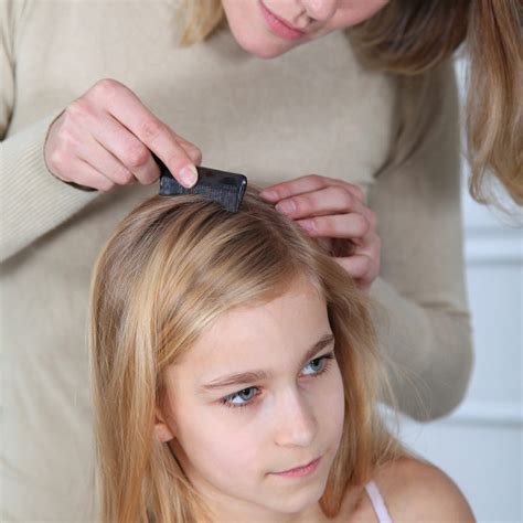 Head Lice Removal and Prevention - Extreme Couponing Mom