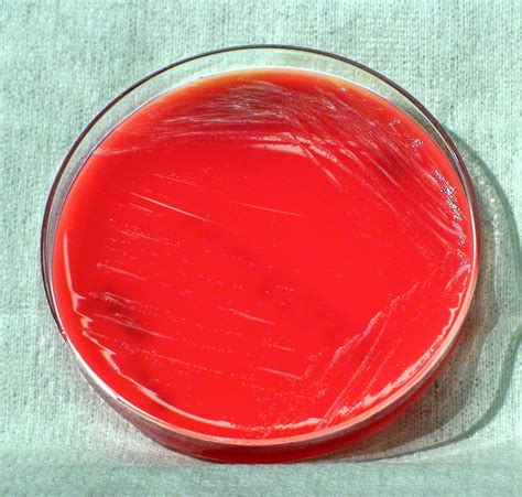 Free picture: bacteriacolonized, modified, thayer, martin, agar