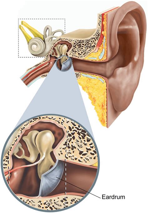 Tympanoplasty Recovery