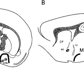 Shematic representations of medial forebrain bundle (MFB) cuts in ...