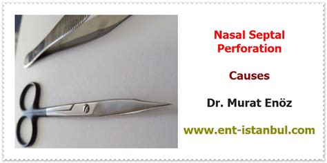 Nasal Septum Perforation - Definition, Causes, Symptoms, Diagnosis and ...