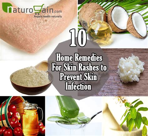 10 Simple and Best Home Remedies for Skin Rashes