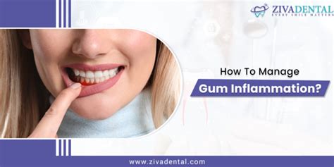 How to Manage Gum Inflammation?