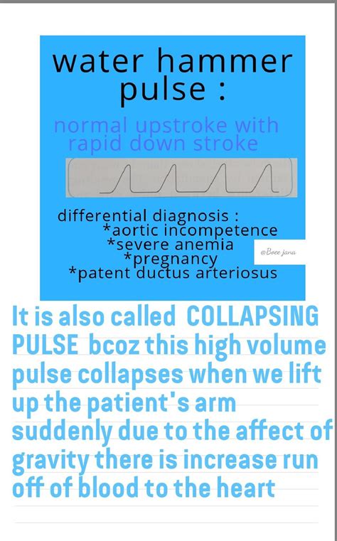 Collapsing pulse in 2021 | Nursing school survival, Cardiology, School survival