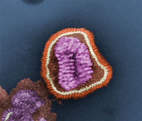 Electron micrograph of influenza virus | Biology of Human/World of Viruses