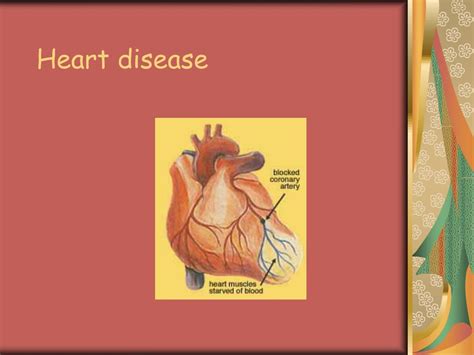 PPT - Heart disease PowerPoint Presentation, free download - ID:343488