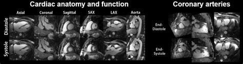 Giving MRI a boost – and a brain • healthcare-in-europe.com