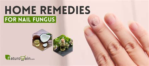 6 Home Remedies for Nail Fungus - Get Rid of Toenail Fungus