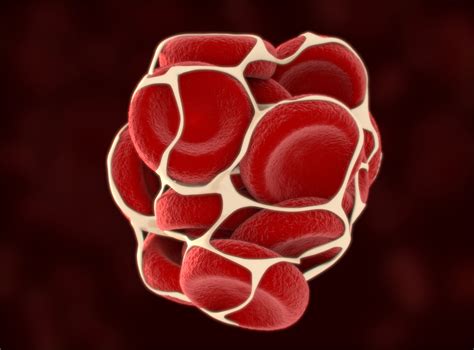 Your Complete Guide to Understanding Blood Clots - USA Vein Clinics