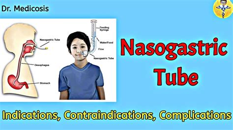 Nasogastric Tube | Indications | Contraindications, Complications | Dr ...