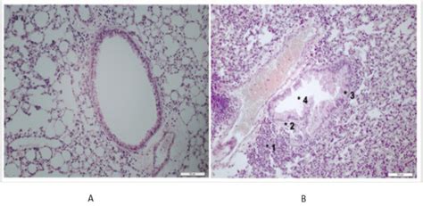 Airway Remodeling in the Asthma Model: Is there Standardization in this Evaluation?