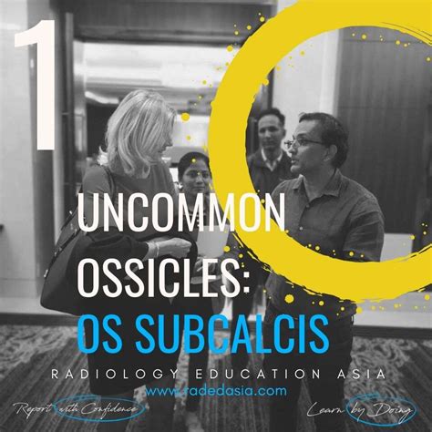 ANKLE OSSICLE OS SUBCALCIS (VIDEO) - Radedasia