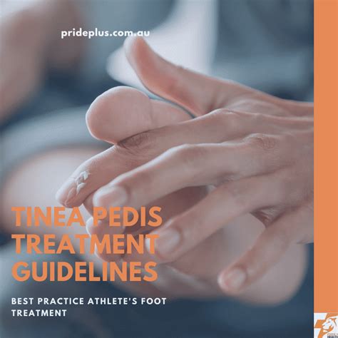 A Podiatrist's Tinea Pedis Treatment Guidelines | Simple Fix