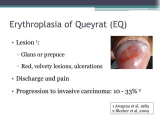 Premalignant penile lesions.pptx