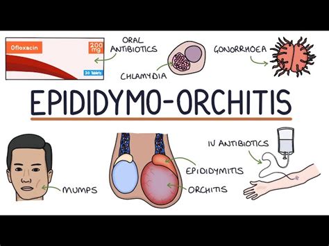 Epididymo Orchitis Cheap Stores | gbu-hamovniki.ru