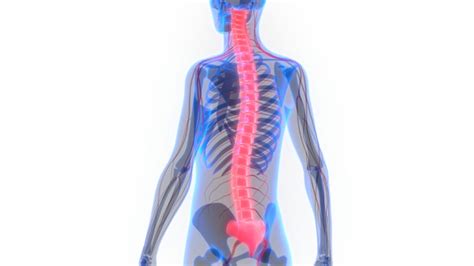 Spinal Shock: Causes, Symptoms, Diagnosis & Treatment - HealthPulls