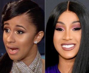 Cardi B Before and After Plastic Surgery: boobs, teeth, nose