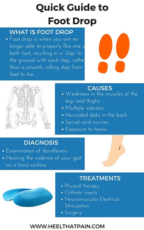 The foot drop test 5 easy exercises for the diagnosis of early drop ...