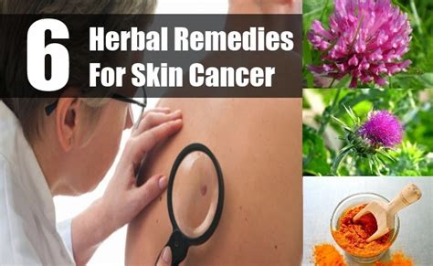 TOP 6 HERBAL REMEDIES FOR SKIN CANCER ~ Mzizi Mkavu