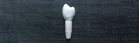 Alternatives For Traditional Dental Implants | Blog