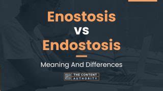 Enostosis vs Endostosis: Meaning And Differences