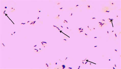 shows Cells of Campylobacter species from isolate colony showing... | Download Scientific Diagram