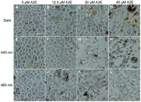 Light-induced morphological changes in A2E-loaded RPE cells. Images of... | Download Scientific ...