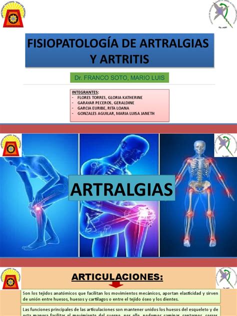 Artralgia y Atrtitis | PDF | Articulación | Artritis Reumatoide