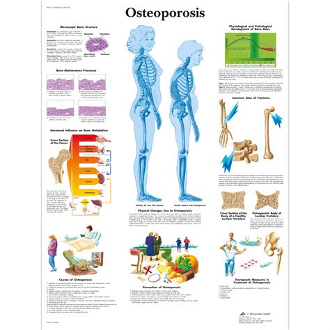 Anatomical Charts and Posters - Anatomy Charts - Geriatric Health ...