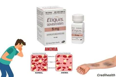 18 Side Effects of Eliquis: Know How to Avoid | Credihealth