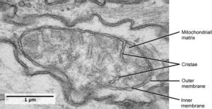 Chloroplast Micrograph