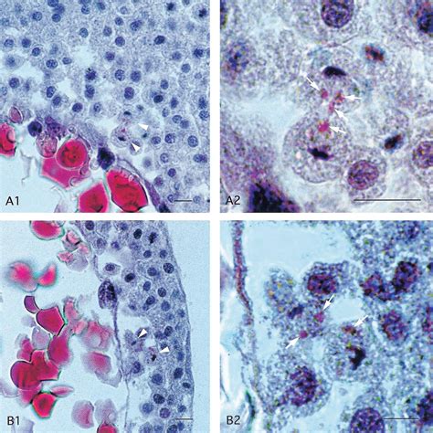 Histological Differentiation of Primordial Germ Cells in Zebrafish