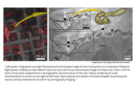 New research paper highlights benefits of integrating Fluorescence and Soft X-ray Microscopy