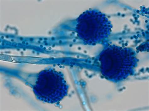 Fun With Microbiology (What's Buggin' You?): Aspergillus fumigatus