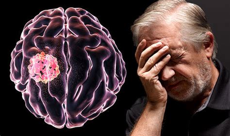 Cancer: Five early symptoms of a brain tumour you must be aware of | Express.co.uk