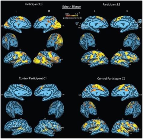 Human Echolocation: How The Blind Can "See"